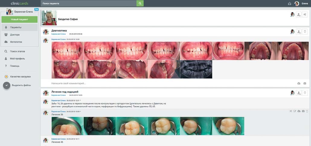 Cliniccards: реальна картка пацієнтки з діагностичними фото і панорамним знімком