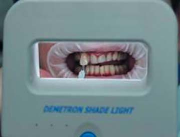 Demetron Shade Light.