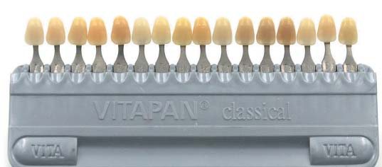 Шкала кольорів VITA Classic.