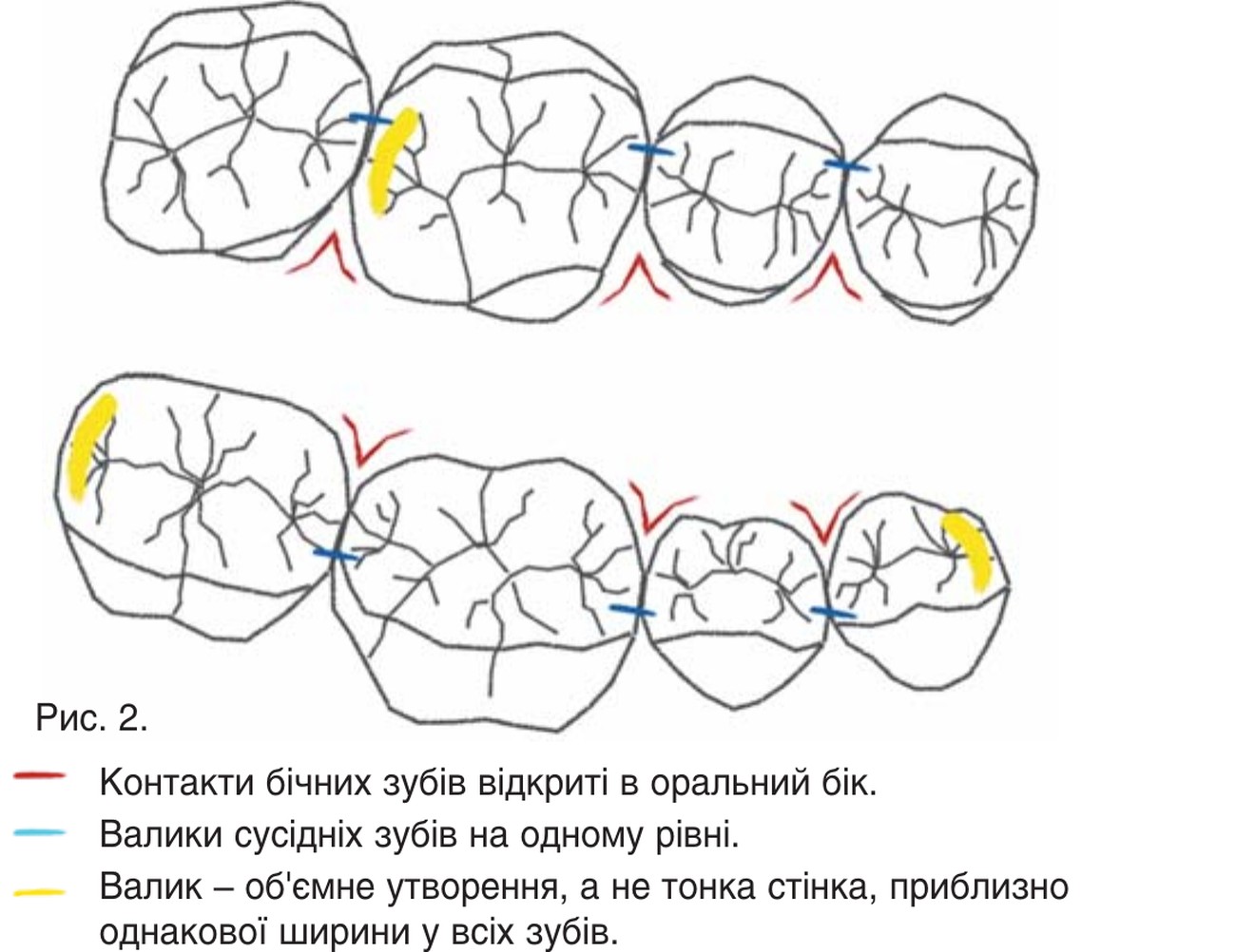Рис. 2. Контакти бічних зубів відкриті в оральний бік; валики сусідніх зубів на одному рівні; валик — об’ємне утворення, а не тонка стінка, приблизно однакової ширини у всіх зубів.