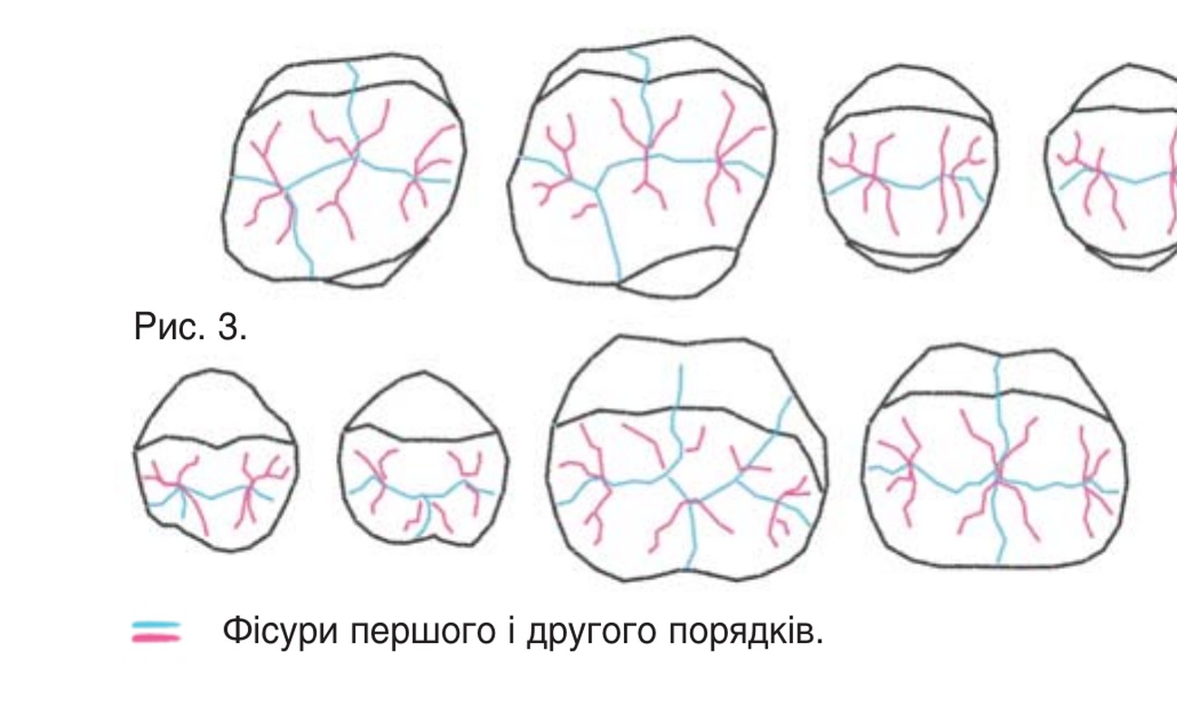 Рис. 3. Фісури першого і другого порядків.