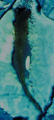 Розчинення тканини пульпи гіпохлоритом натрію, кадр 3