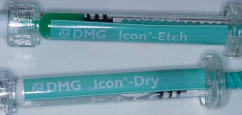 Шприци Icon etch з аплікаторами. Після цього наноситься Icon dry (спирт) від DMG.