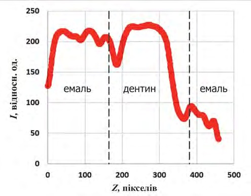 Інтенсивність бічного розсіювання в зоні середини ріжучої третини