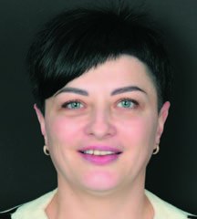 До реставрації.