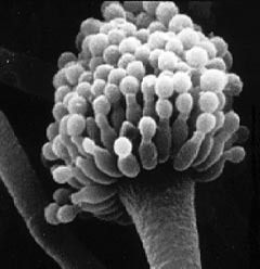 Фото 3-5: апікальна третина кореневого каналу з обтураційним матеріалом, Aspergillus fumigatus, аспергильоз верхньощелепного синуса