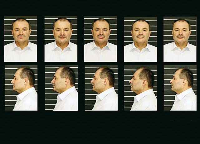 Етапи біоестетичної реконструкції: MAGO, воскове моделювання, мокап, препарування, тимчасові конструкції та керамічні реставрації (до і після)