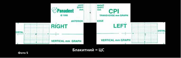 Передня накусувальна пластинка MAGO і реєстрація центрального співвідношення
