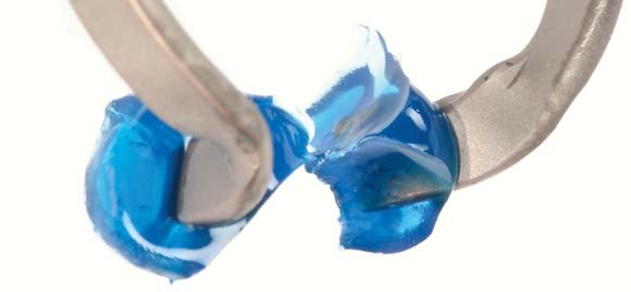 Кільце з індивідуалізованою формою проксимальних переходів Custom Ring