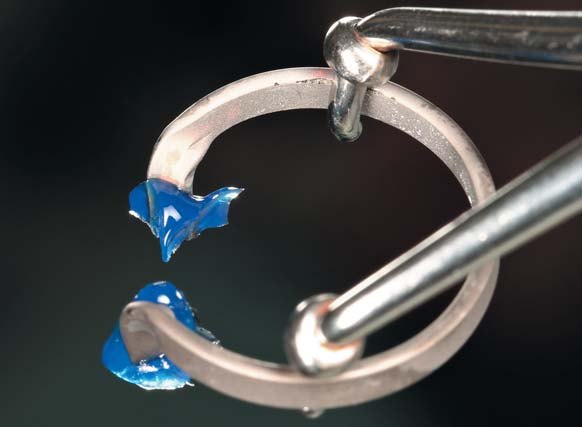 Доопрацювання кільця Custom Ring алмазним бором