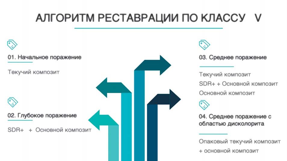 Алгоритм відновлення пришийкових дефектів (Клас V) залежно від глибини ураження: початкове, середнє та глибоке.