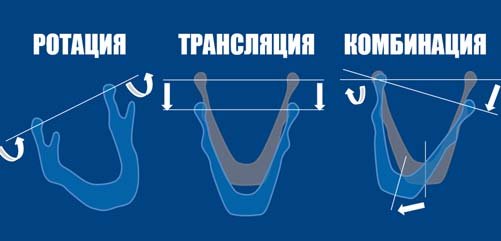 Ротація, трансляція і комбінація рухів суглобової голівки