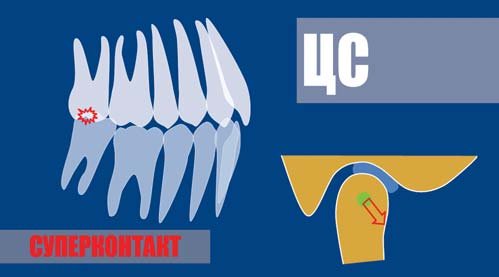 Схема центрального співвідношення