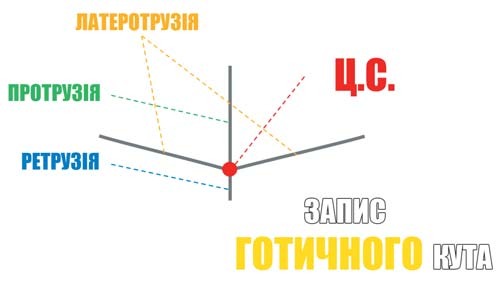 Схема запису готичного кута