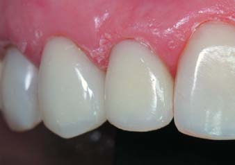 Результат реставрації