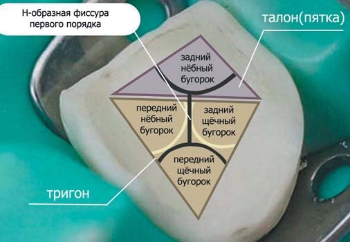 Крок моделювання коронкової частини першого моляра верхньої щелепи