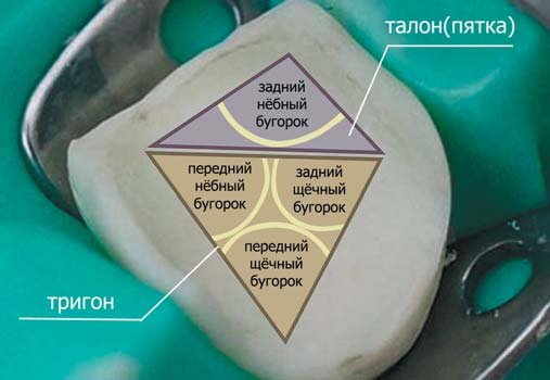 Крок моделювання коронкової частини першого моляра верхньої щелепи