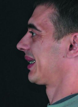 Рік лікування, проміжна діагностика