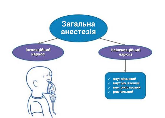 Схема класифікації видів анестезії