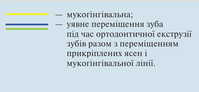 Умовні позначення: мукогінгівальна; уявне переміщення зуба під час ортодонтичної екструзії зубів разом з переміщенням прикріплених ясен і мукогінгівальної лінії