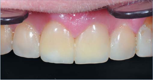 після реставрації
