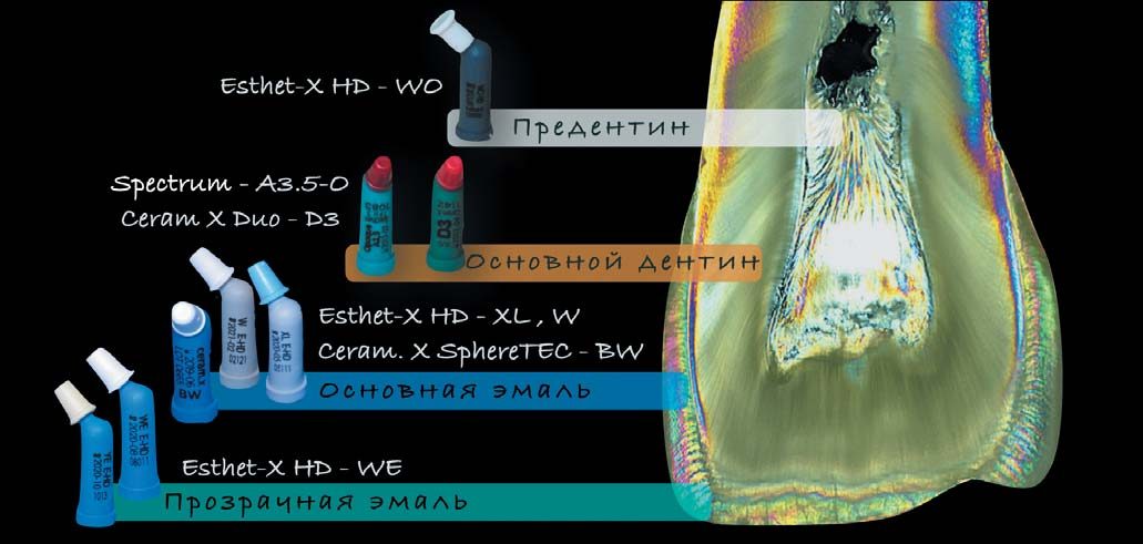 Схема колірного рецепту матеріалами фірми Dentsply Sirona