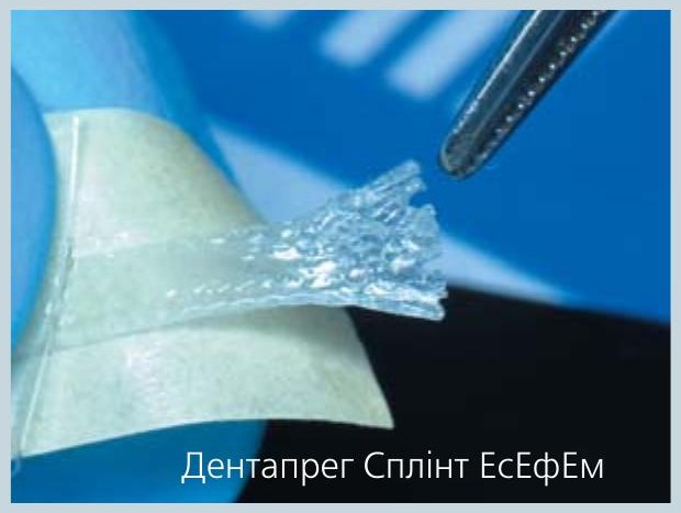 Дентапрег Сплінт ЕсЕфЕм