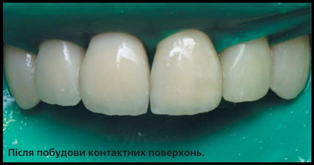 Клінічний приклад 5