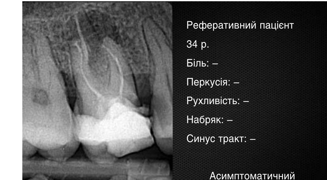 Передопераційний знімок. На момент звернення скарги відсутні.
