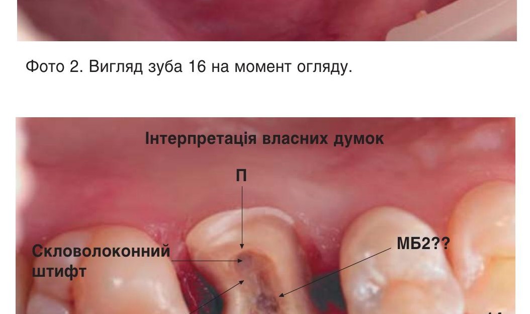 Вигляд під збільшенням…