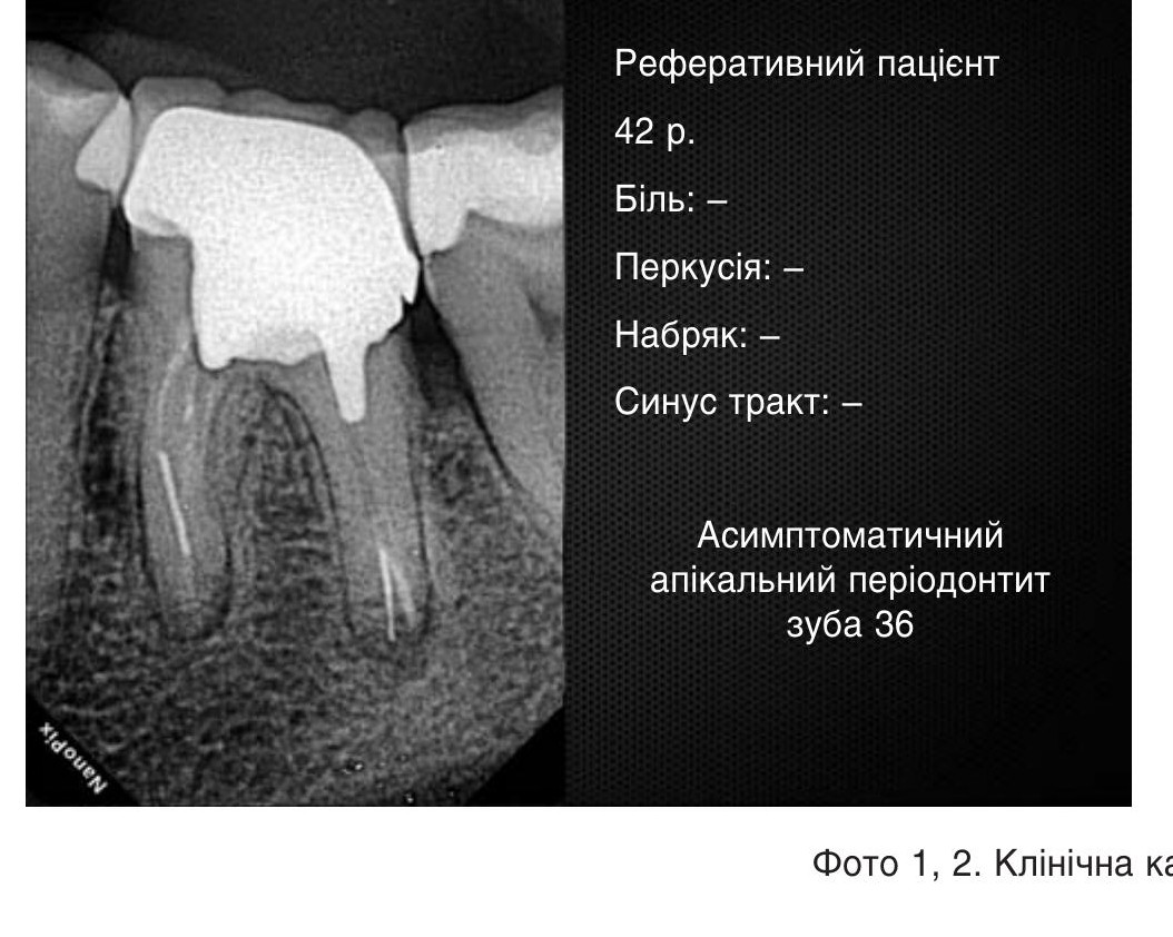 , 2. Клінічна картина до втручання.