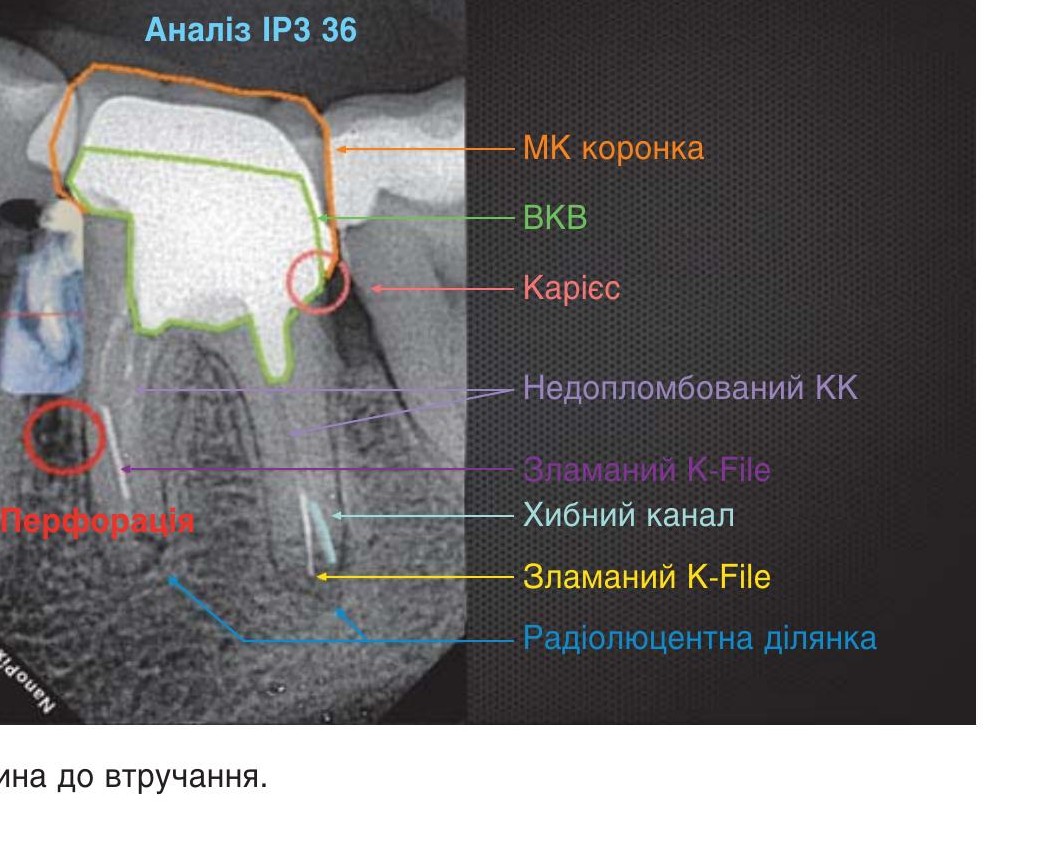 , 2. Клінічна картина до втручання.