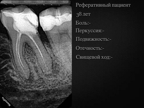 Передопераційний знімок; на момент звернення скарги відсутні.