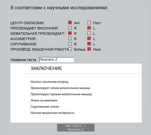 Дані синхроміографії до реставрації.