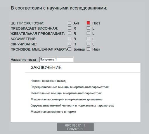 Дані синхроміографії після реставрації.