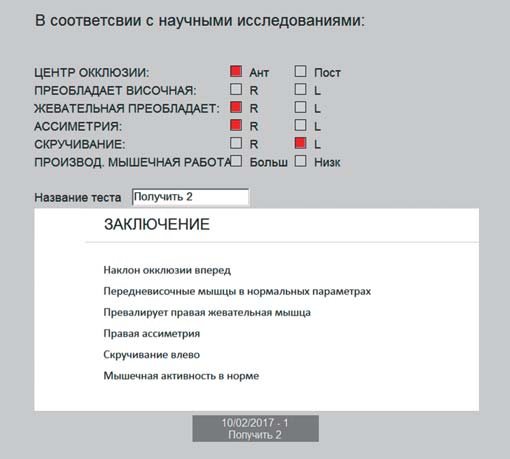 Дані синхроміографії через місяць.