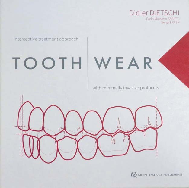 Обкладинка монографії Didier Dietschi, Carlo Massimo Saratti, Serge Erpen «Tooth Wear. Interceptive Treatment with Minimally Invasive Protocols» (Quintessence, 2023, 841 с.)