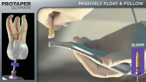(продовження). «Passively float & follow»: наконечник Slider утримують подалі від головки, щоб запобігти небезпечному тиску в каналі.