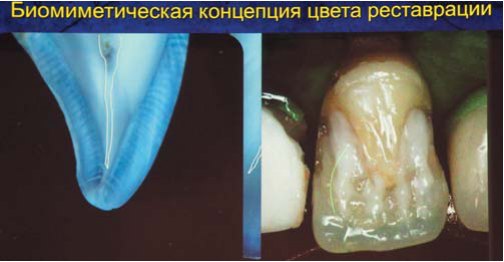 Сергій Радлінський (Україна)
