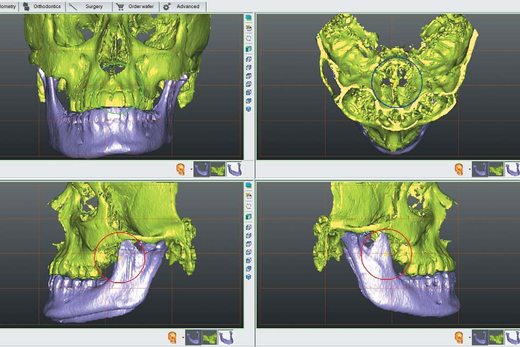 Конусно-променева комп'ютерна томографія і 3D-цефалометрія: метод вивчення черепно-щелепно-лицьових деформацій