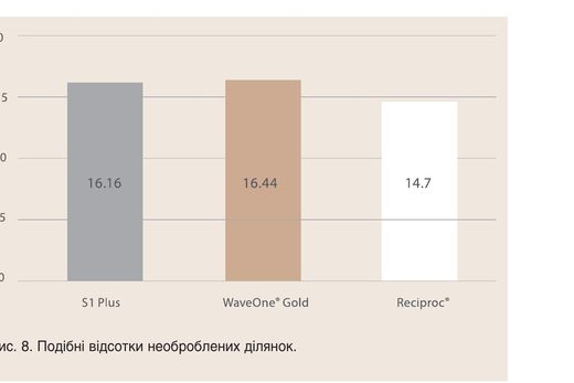 WaveOne® Gold – ендодонтична система нового покоління. Частина 2