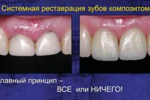 Міжнародний осінній семінар ДентАрт 2014. Аполлонія-драйв