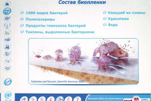 Міжнародний весняний семінар ДентАрт 2013. Стоматологія під збільшенням