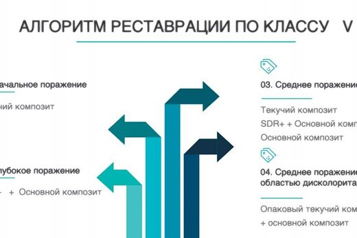 Алгоритми відновлення пришийкових дефектів зубів
