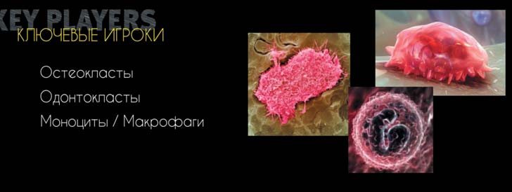 Остеокласти, одонтокласти, моноцити/макрофаги; зовнішня цервікальна резорбція кореня, симптом «рожевої плями»