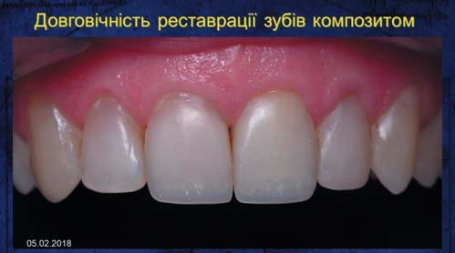 Властивості зубних тканин і реставраційних матеріалів (таблиця)