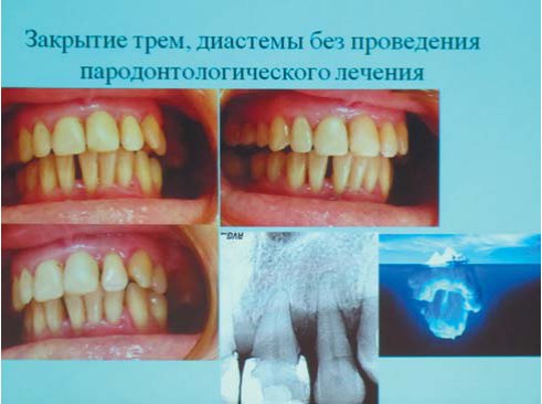 I Конгрес УАЕС