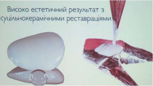 I Конгрес УАЕС