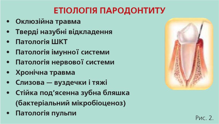 Етіологія гінгівіту. Етіологія пародонтиту