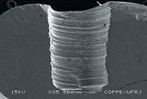Порожнина після препарування алмазним бором, а